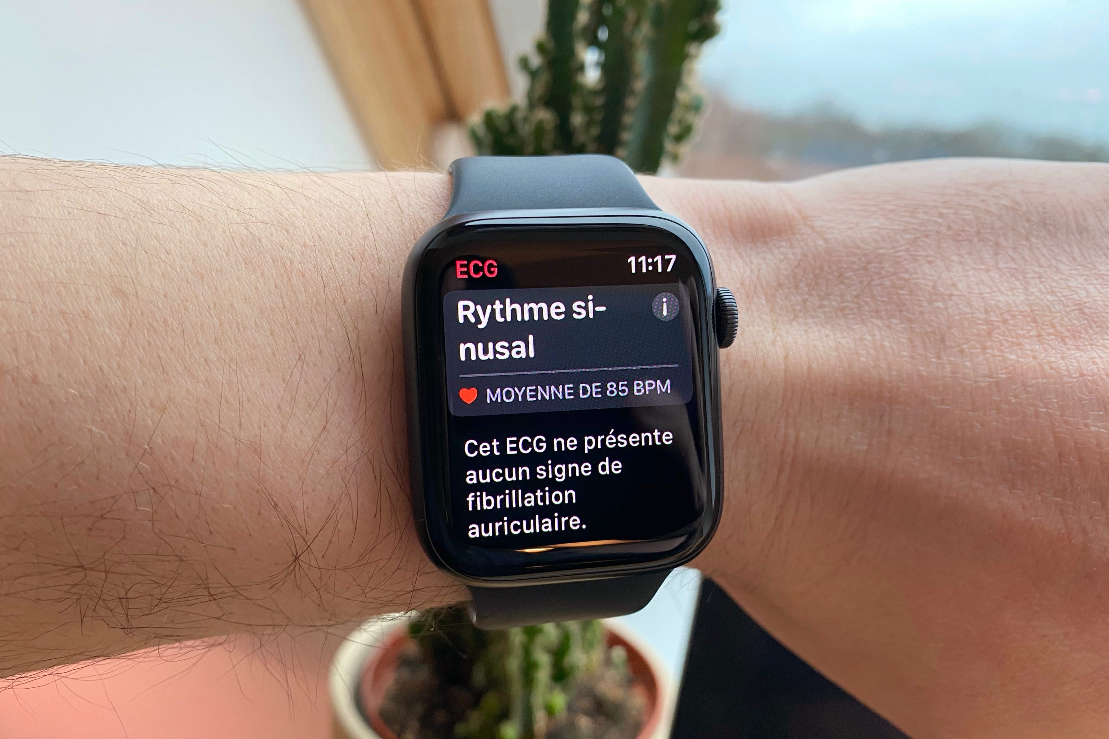 apple watch rythme cardiaque fiabilite