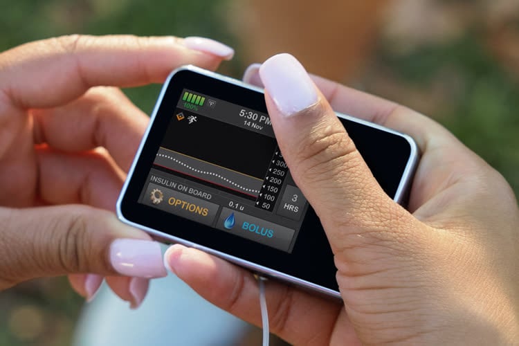 Le bug d’une appli iOS vide la batterie d'une pompe à insuline : plus de 200 personnes affectées