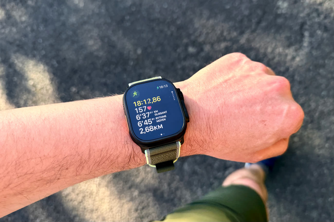 Image : WatchGeneration